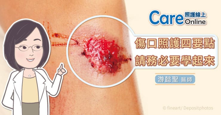 傷口搽什麼？居家急救免慌張！