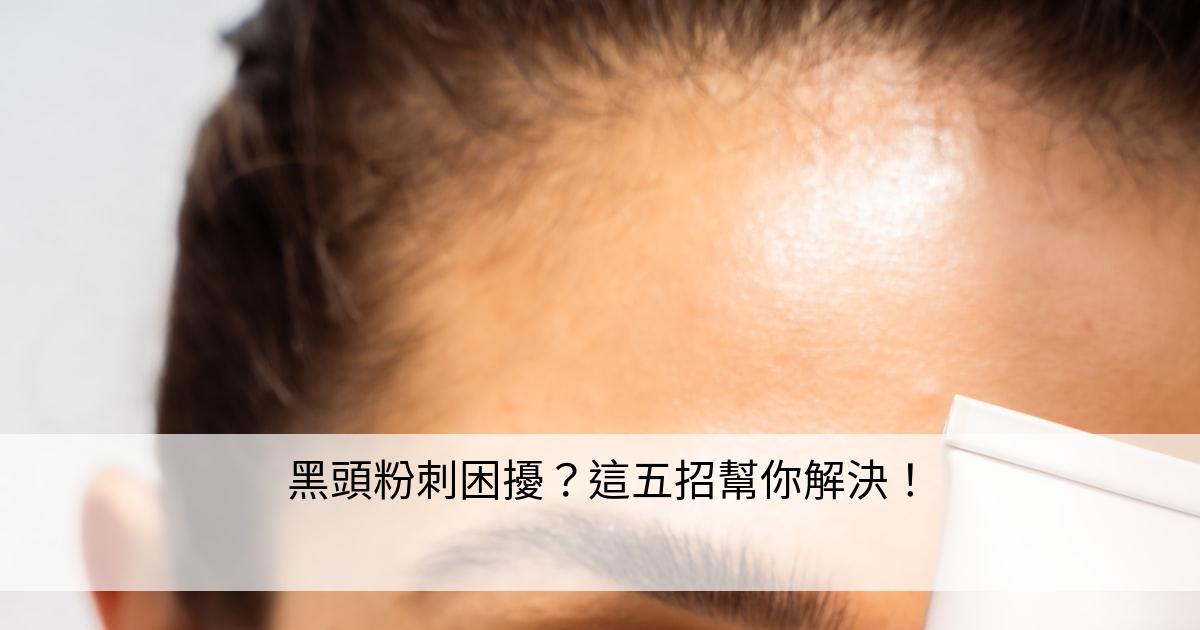 如何針對黑頭問題進行深層清潔？高效解決黑頭困擾的完整教學