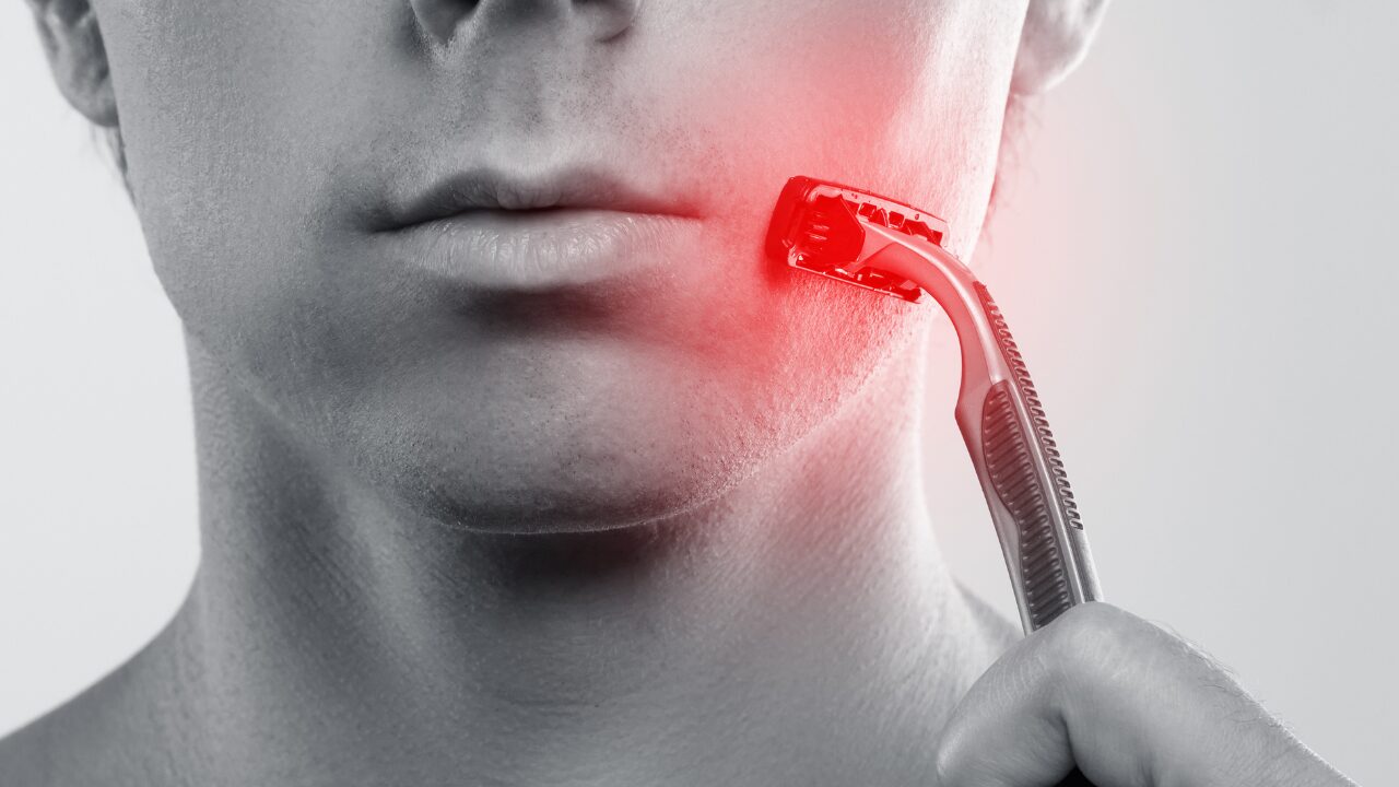 敏感肌・炎症肌必見！肌を鎮静させるスキンケア方法の完全ガイド