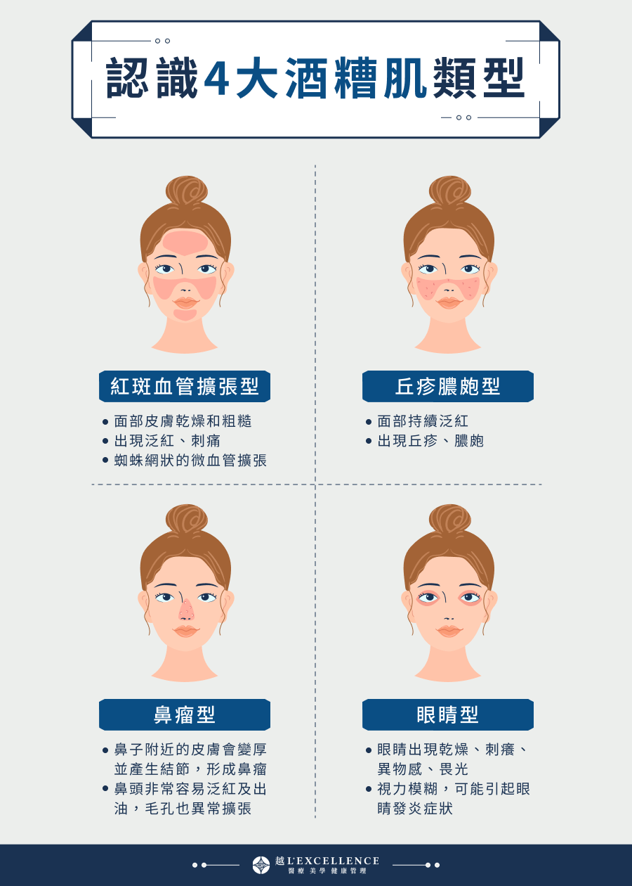 酒糟無法根治？破解常見迷思，有效控制症狀！