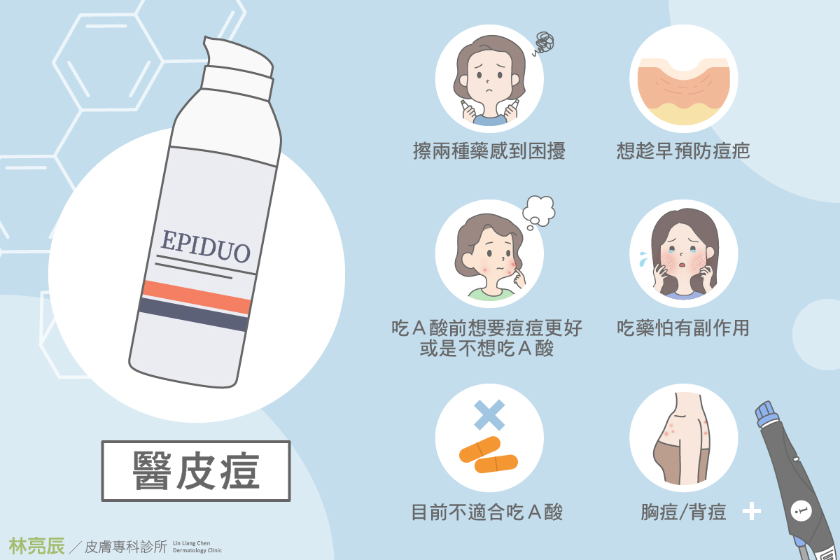 如何預防痘痘形成的護膚日常：皮膚科醫生完整教學，告別痘痘肌膚！