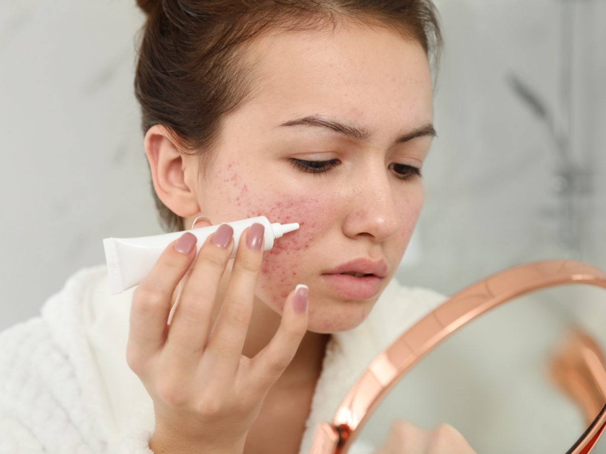 面膜過敏急救攻略：冰鎮紓緩肌膚不適