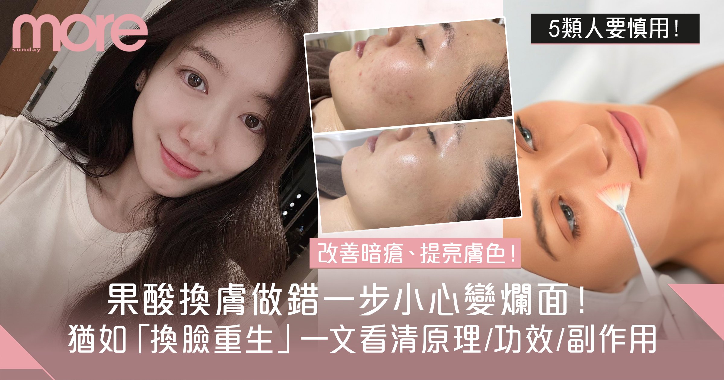 換季時可以進行果酸換膚或雷射療程嗎？醫師親授：換季醫美攻略與保養秘訣！