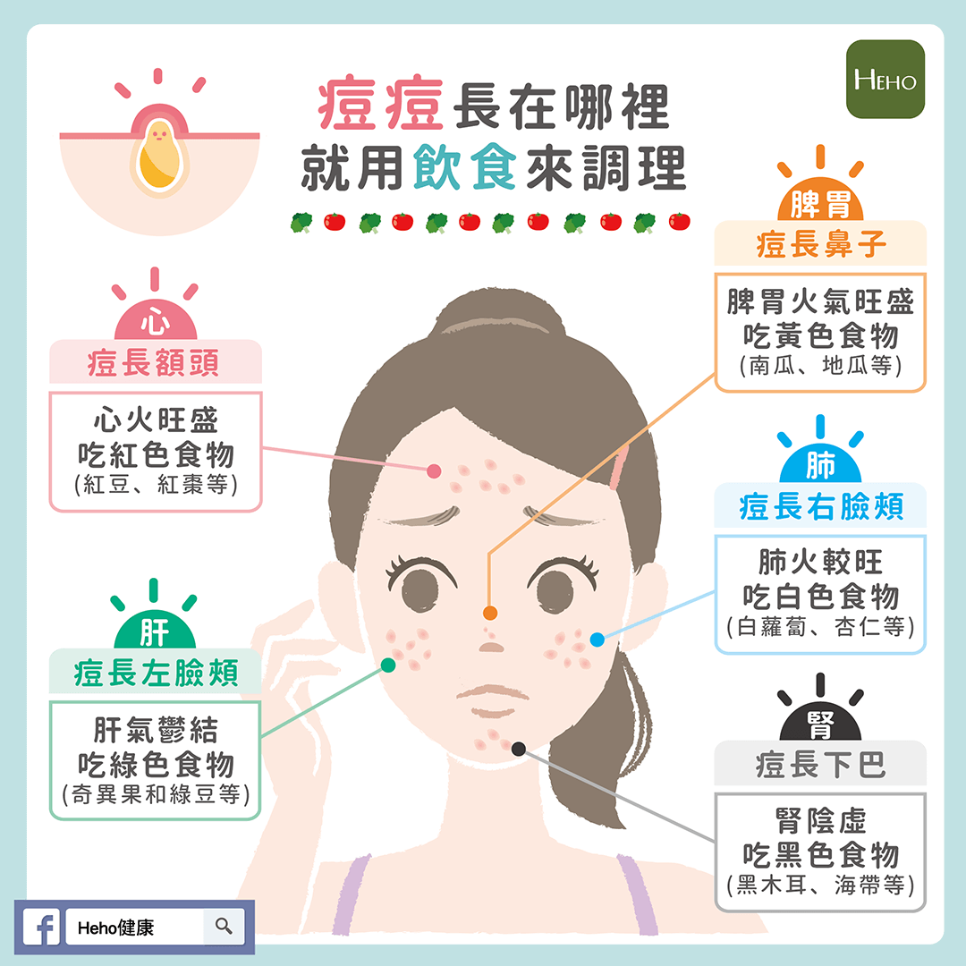 痘痘OUT！破解長痘原因與最佳對策