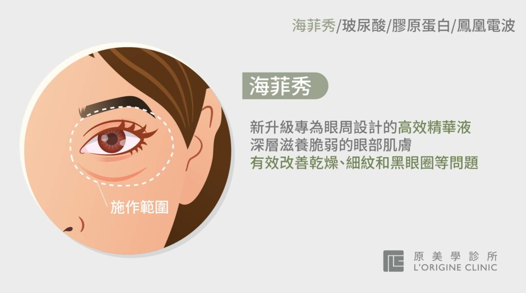 如何針對眼袋問題設計護理方案：高效眼袋改善攻略