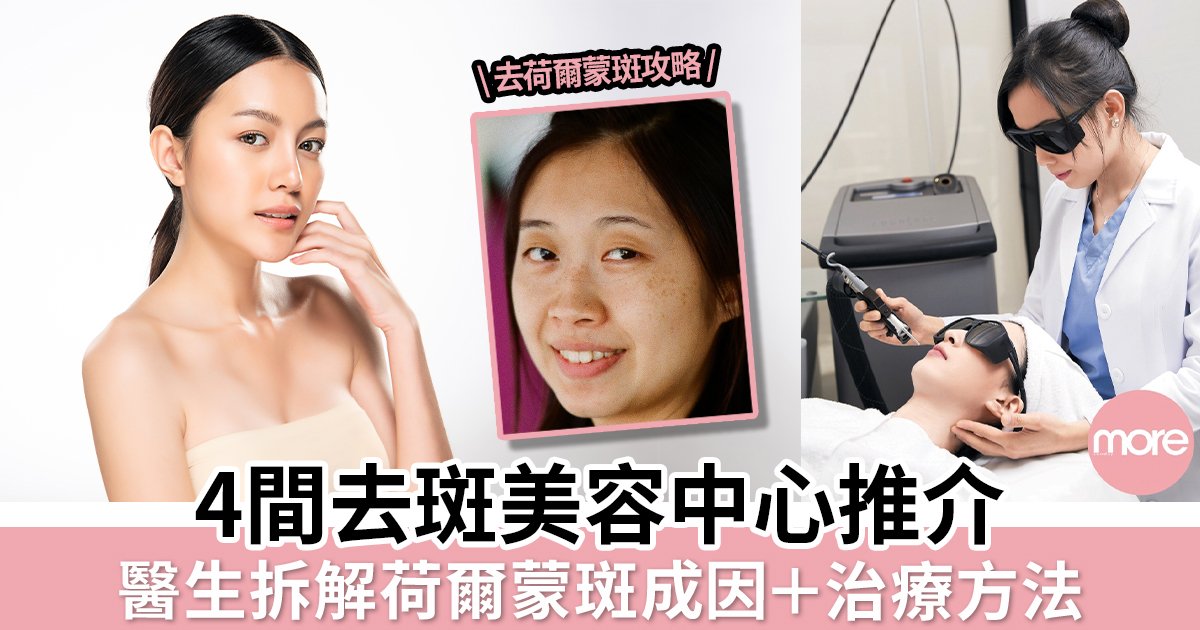 告別色斑！皮膚科醫生教你色斑形成的原因與淡化技巧