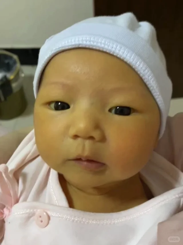 新手爸媽必知的新生兒黃疸原因與預防：完整教學及照護攻略