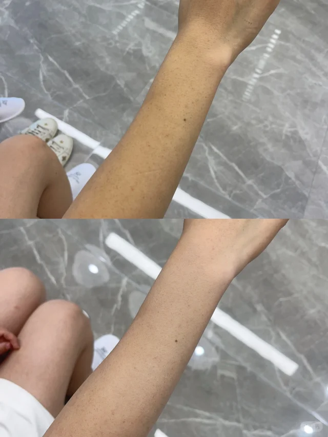 如何選擇美容院專業美白療程？高效美白攻略與安全指南