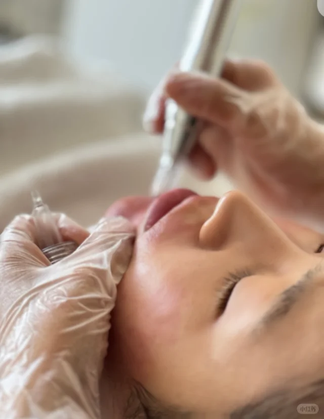 如何選擇美容院專業微針療程？十年皮膚科醫生完整教學及避坑指南