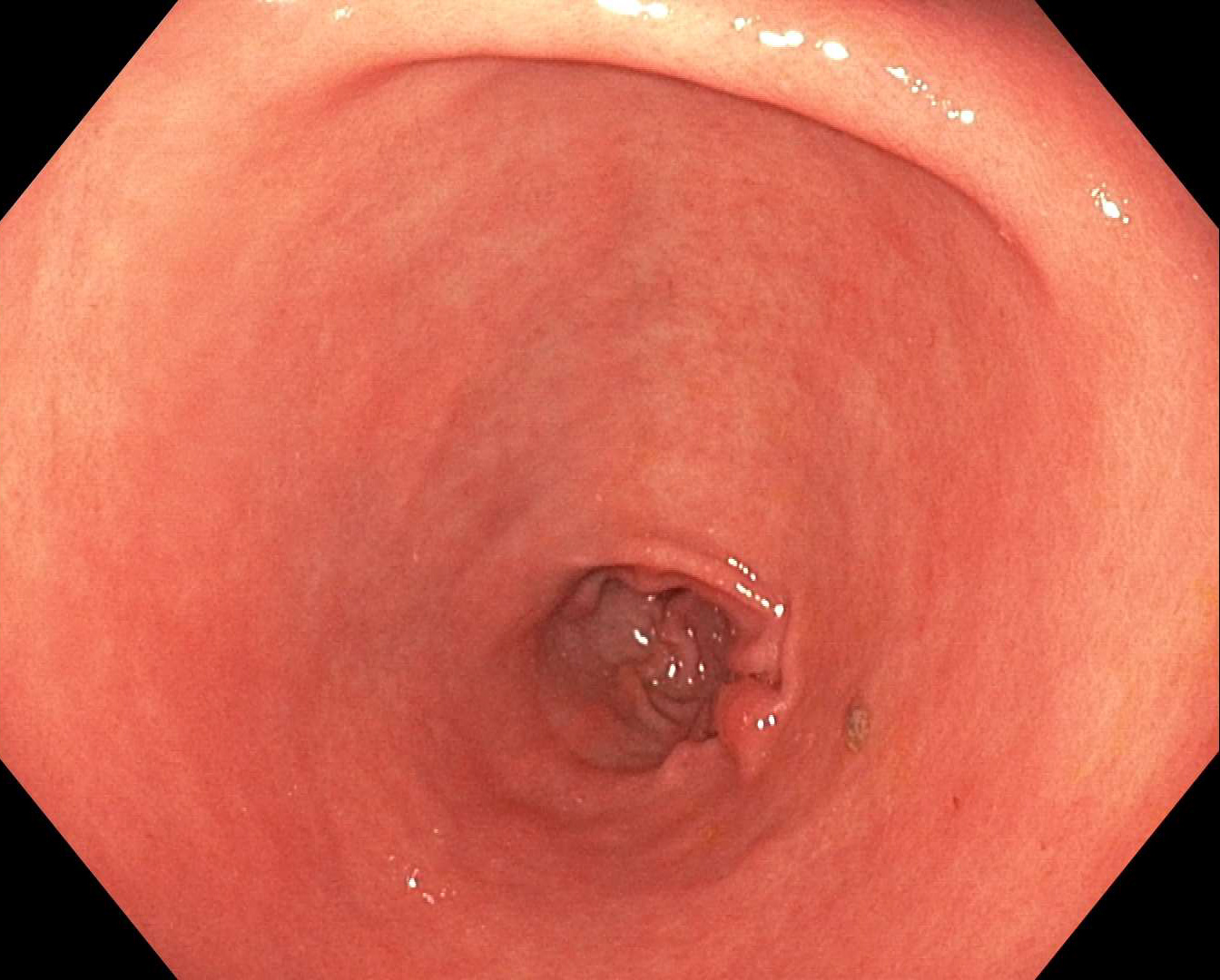 果乾水如何減少脹氣問題？高效舒緩脹氣的完整教學