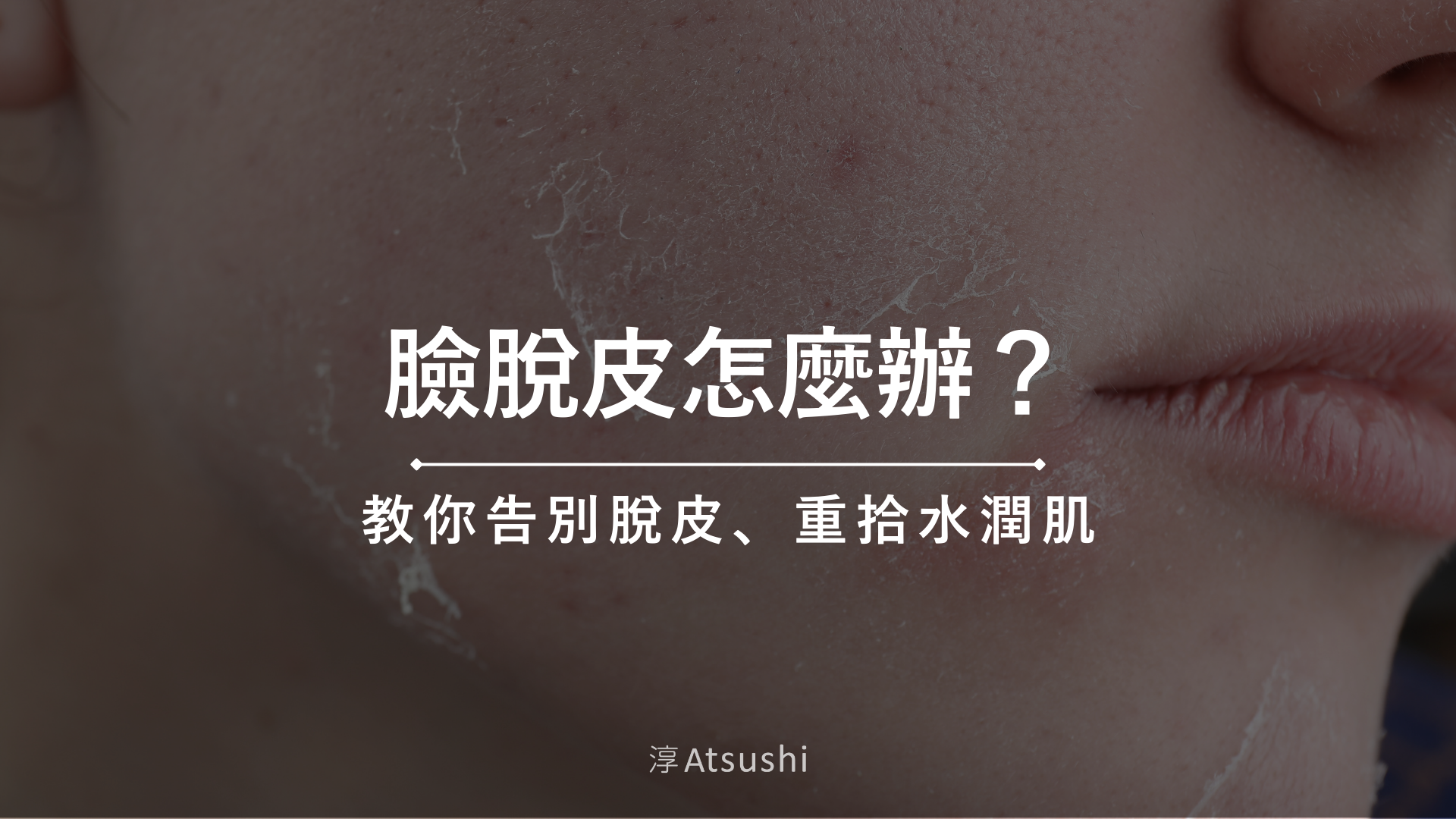 騎車通勤導致臉部乾燥脫皮的防護指南：皮膚科醫師教你高效解決通勤肌膚問題