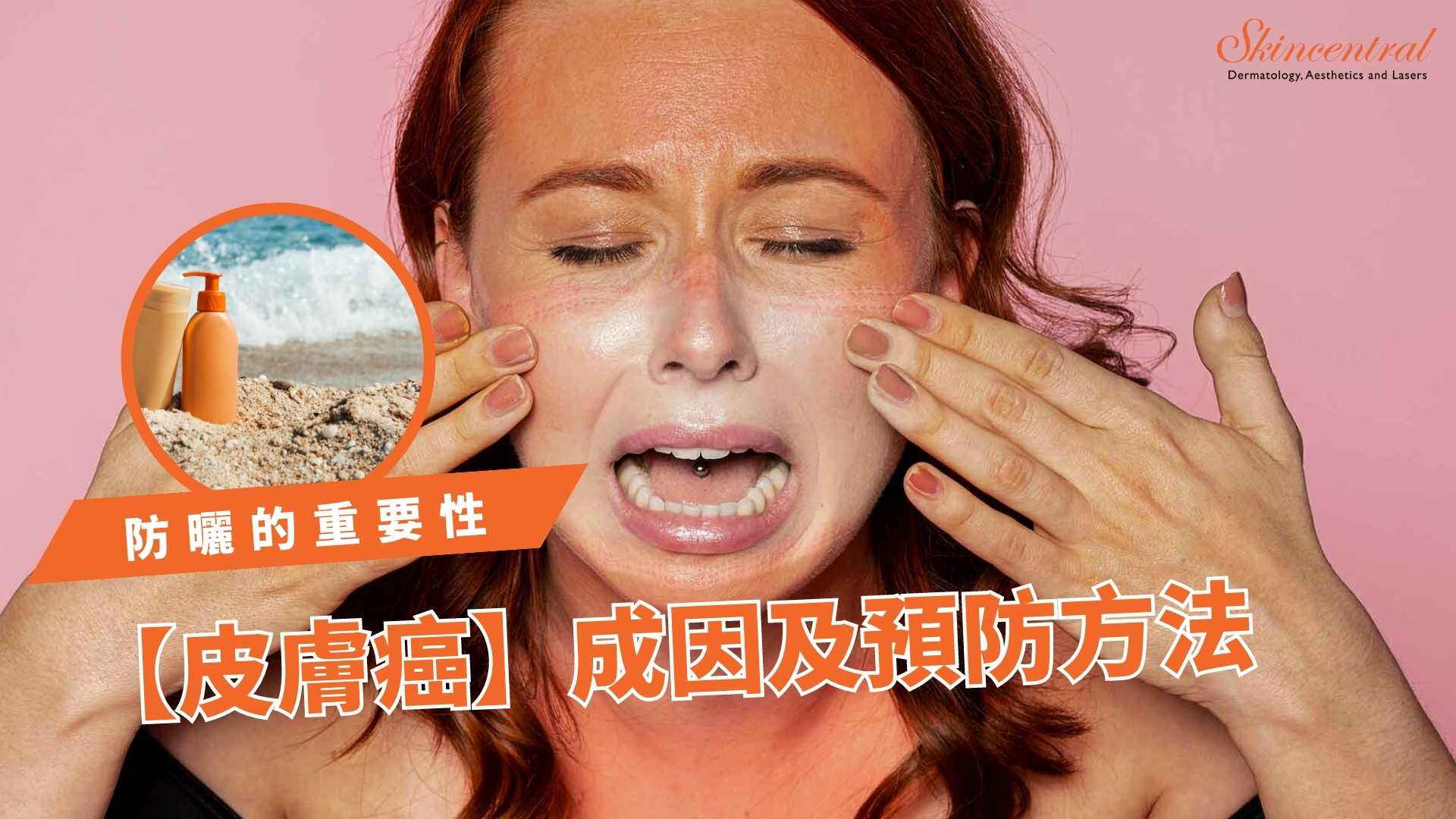 防曬在護膚日常中的重要性：高效防曬攻略，預防早衰和皮膚癌！