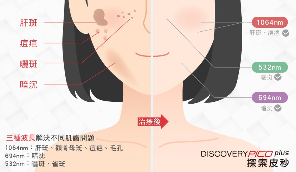 如何應對暗沉膚色？這些成分不可少！皮膚科醫生親授高效美白攻略