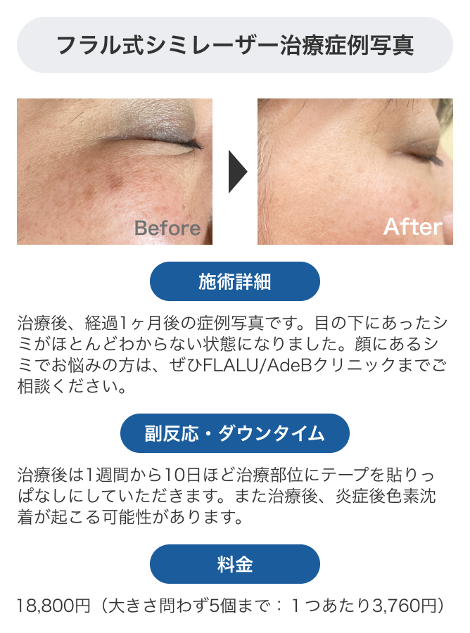 シミを減らすためのスキンケア術｜美肌への効率的攻略法