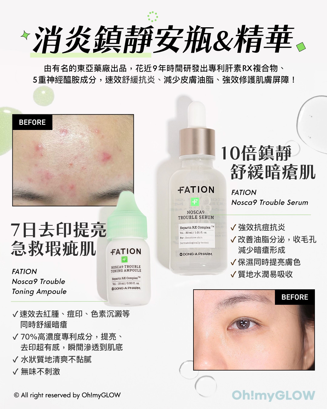 如何選擇針對痘印的護膚產品？痘印淡化高效指南