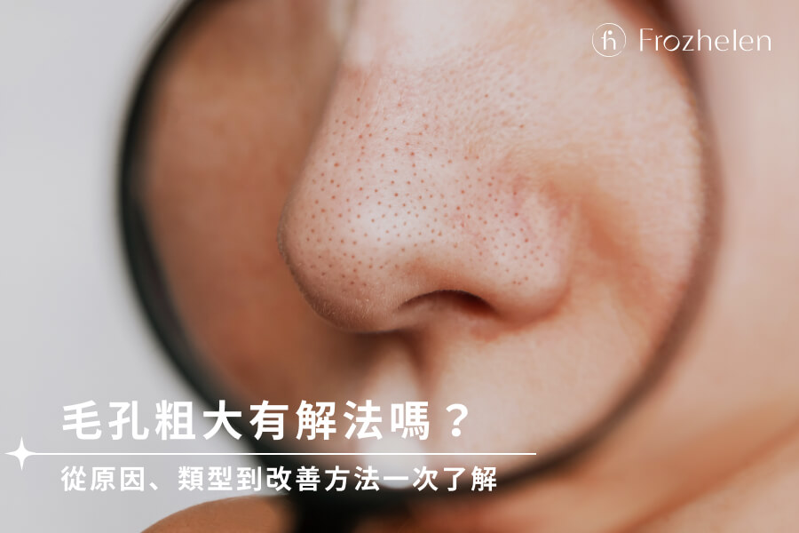 針對毛孔粗大問題的有效護膚方案：十年皮膚科醫生教你告別粗大毛孔！