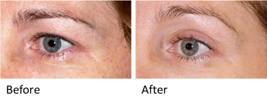 如何設計針對眼部的基礎護護理方案：3步驟打造亮眼電眸！