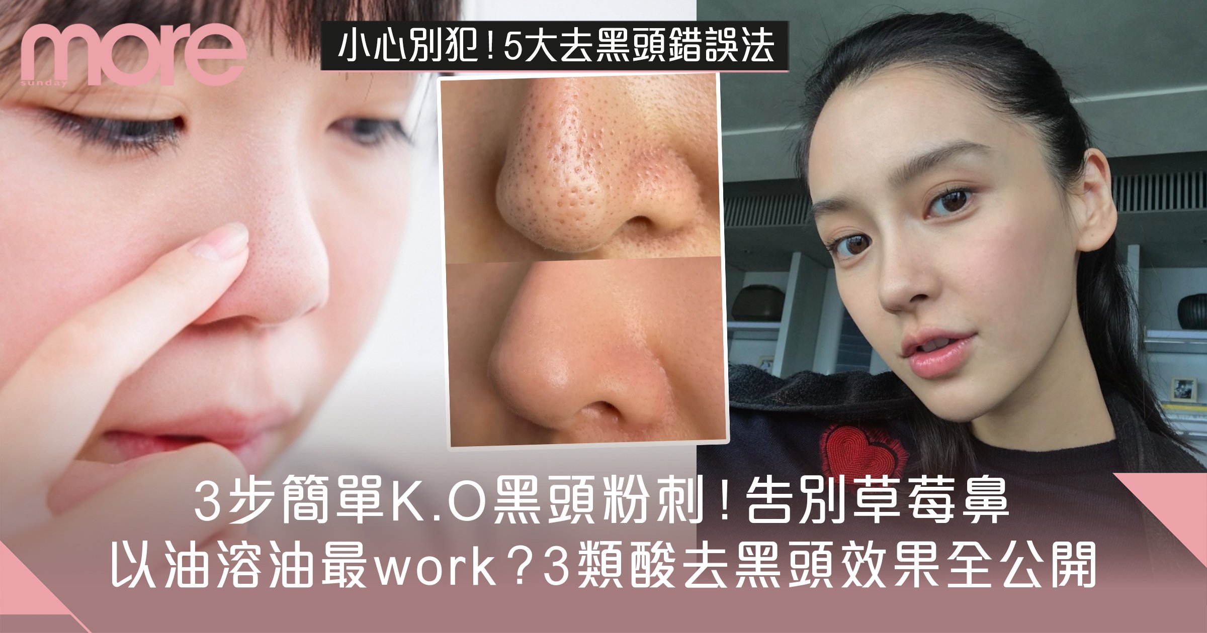 去除黑頭的方法與日常保養建議：告別黑頭，擁有淨透美肌的完整教學