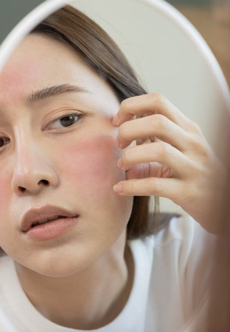 如何應對秋冬季節的肌膚敏感？敏感肌必學的完整護膚攻略