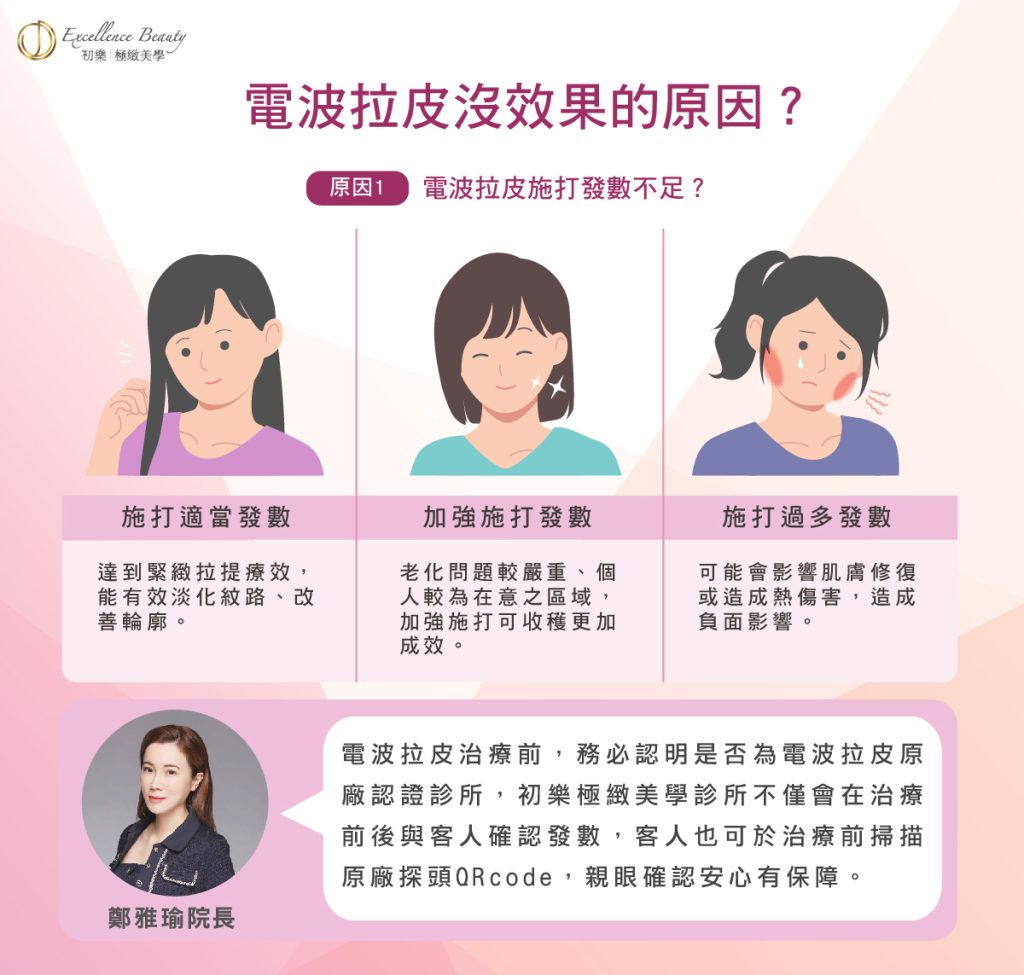 電波拉提術後的鎖水保養：維持緊緻曲線，美麗持久的秘密！