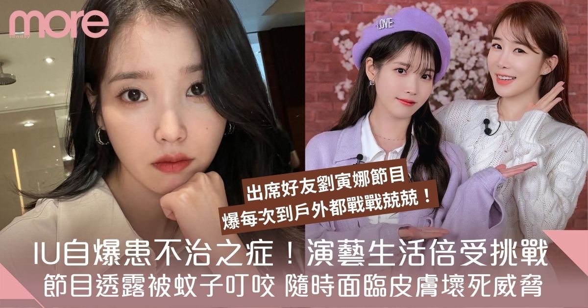IU驚爆罹患罕見斯基特症候群！童年留疤至今，蚊蟲叮咬竟致皮膚壞死