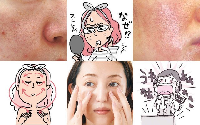 ストレスが肌とスキンケアルーティンに与える影響：敏感肌・ニキビ対策の完全ガイド