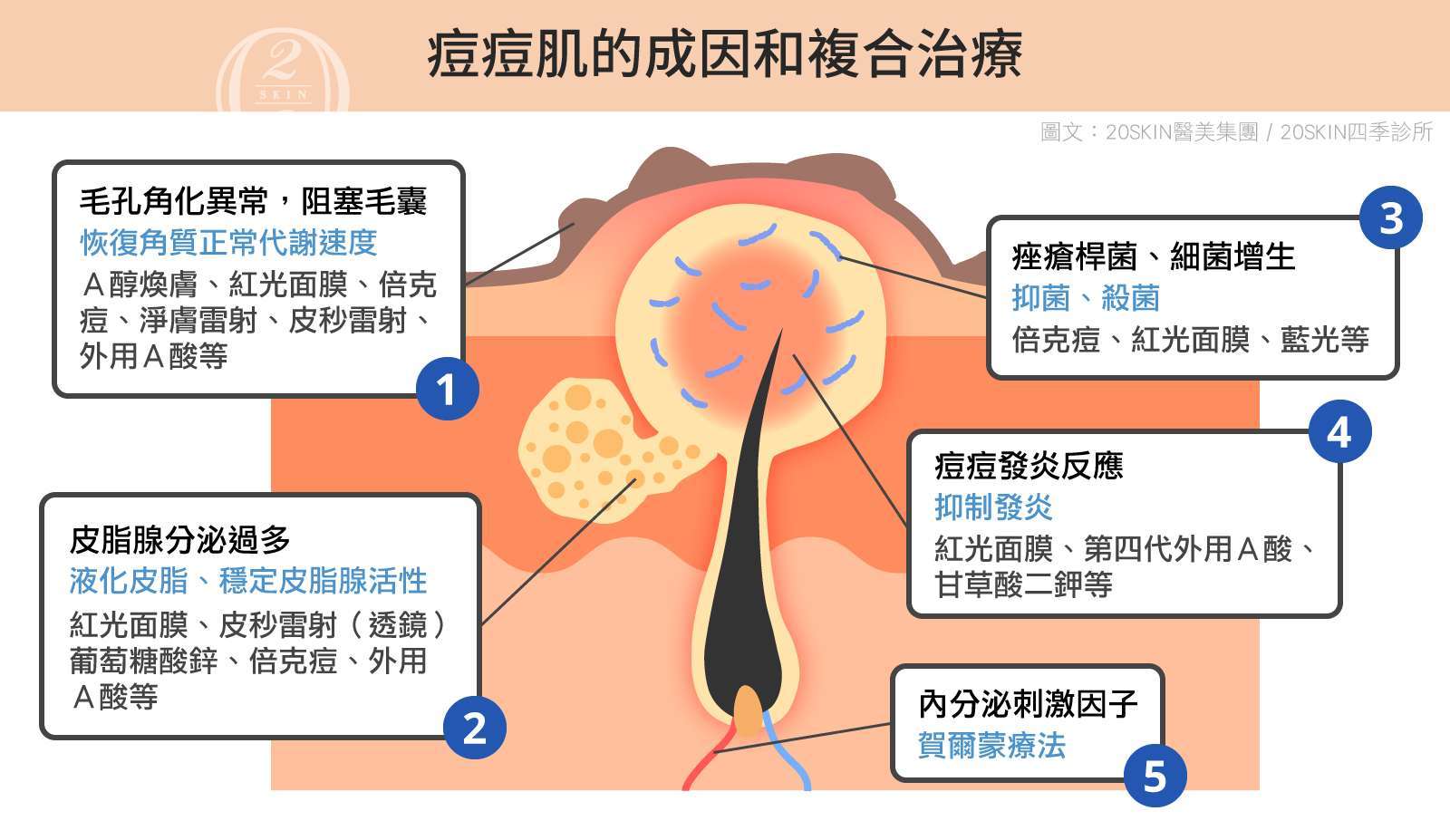 痘痘與粉刺的區別及護理方法：完整教學，告別肌膚困擾！