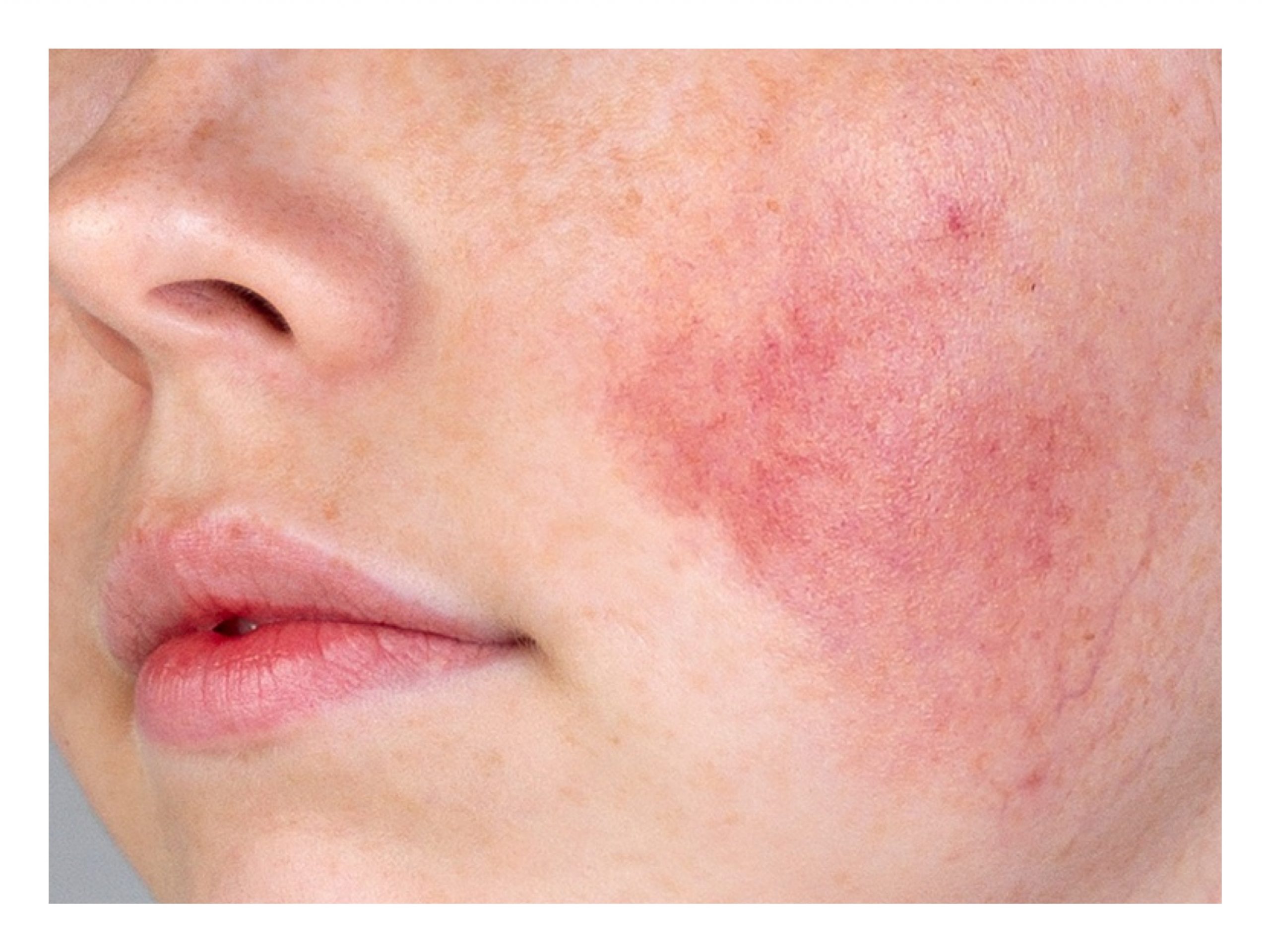 Yaya Mini舒緩膏特點分析：高效舒緩敏感肌的保養秘訣