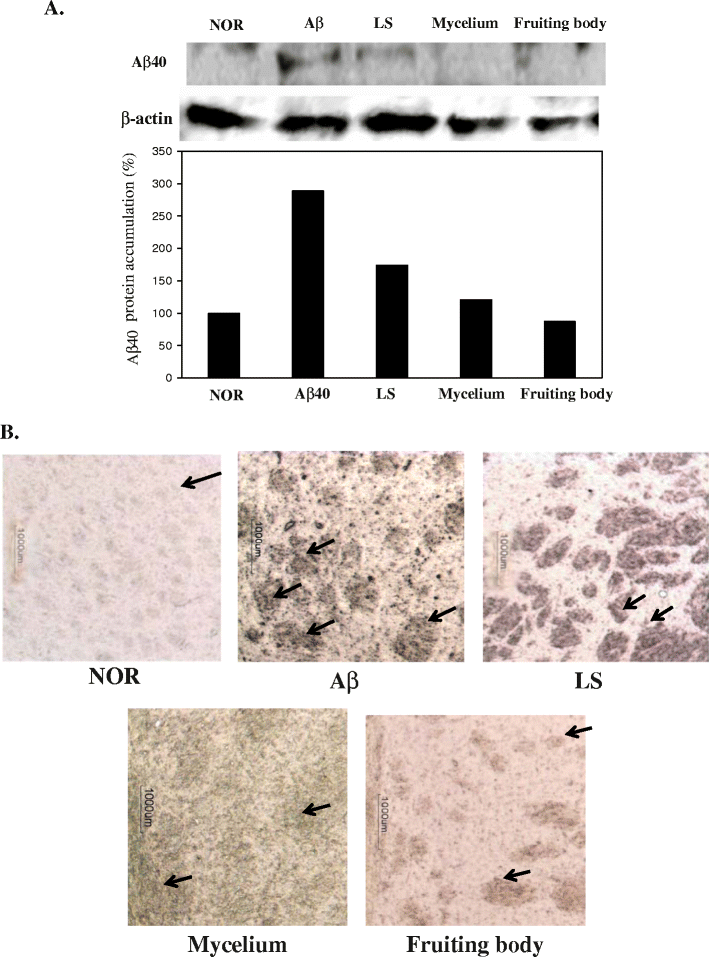 葡眾樟芝益產品資訊完整解析：功效、用法、潛在風險及醫師專業建議