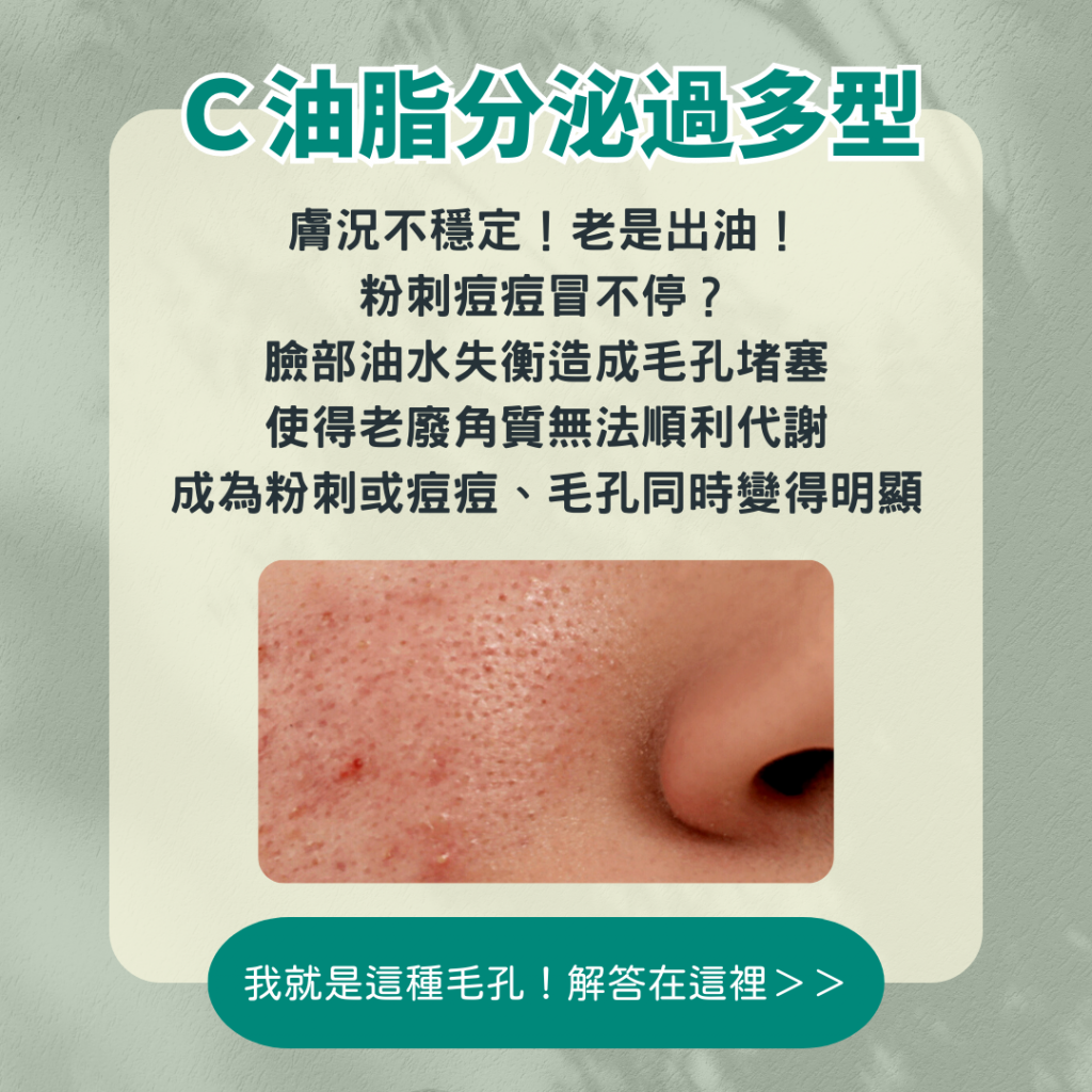 改善毛孔粗大必學指南：油脂過多、肌膚老化竟是元凶！