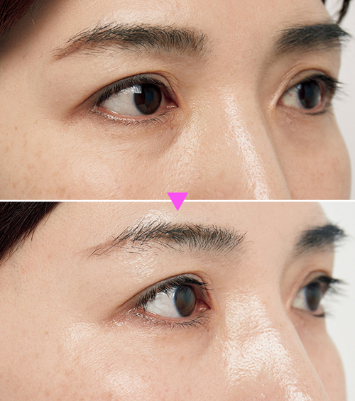 目元のケアに特化したスキンケア製品の選び方：40代からの目元美容の秘訣