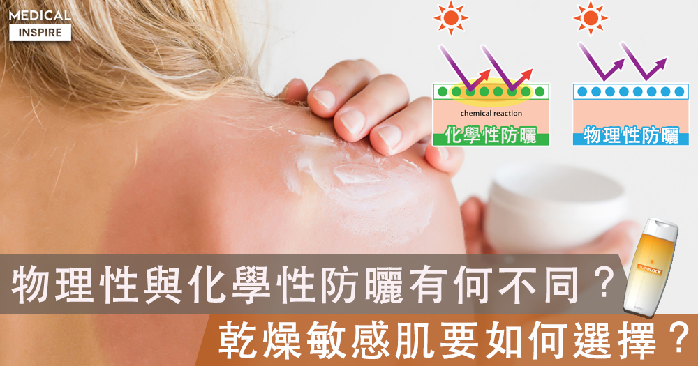化學性防曬：保護肌膚，敏感肌膚切記留心