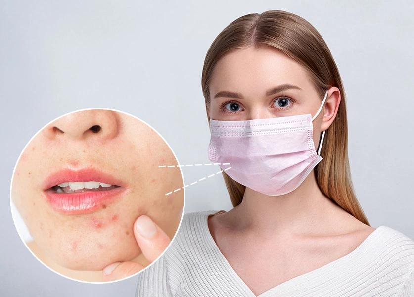 如何選擇適合長時間佩戴口罩的護膚品？痘痘肌、敏感肌的完整保養攻略