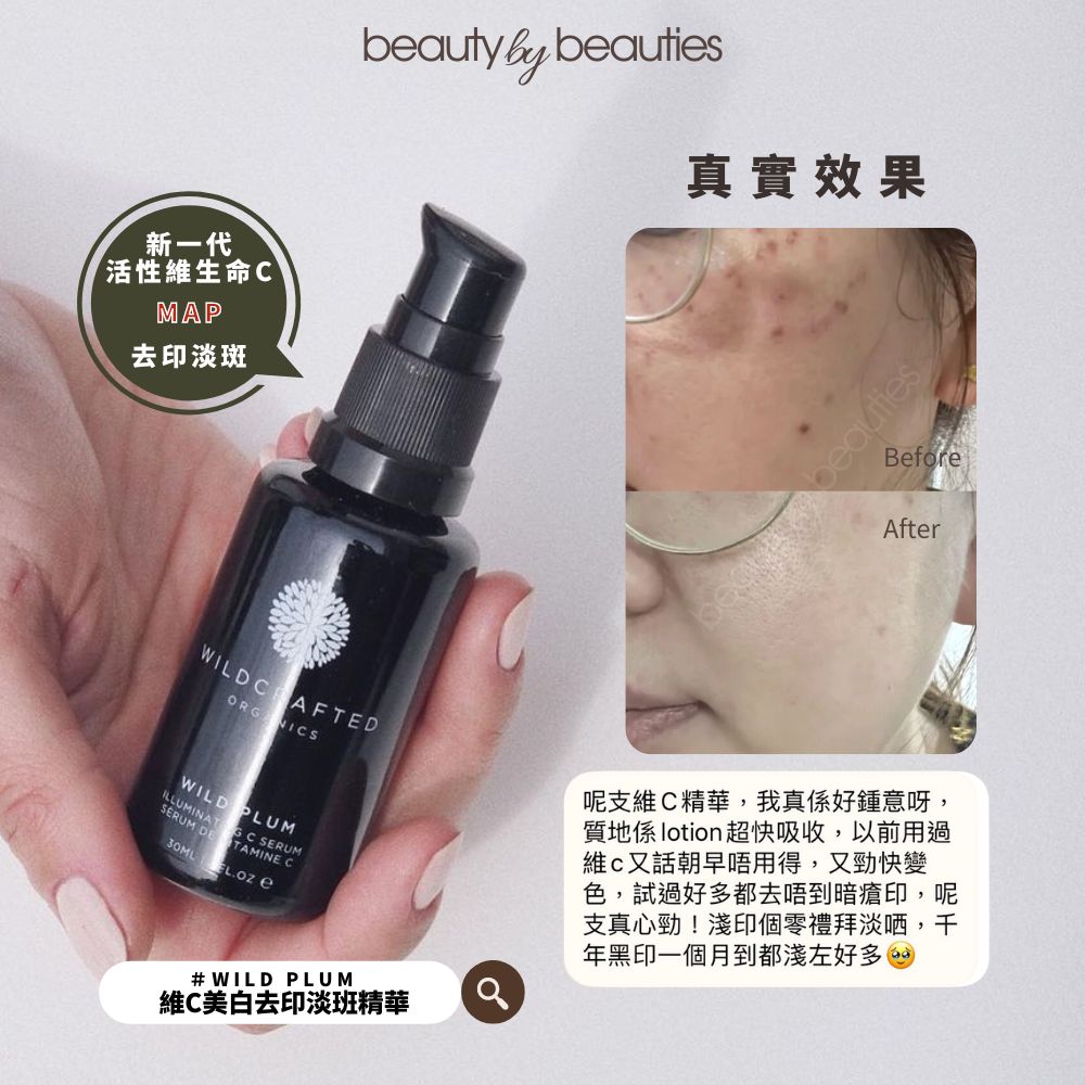 減少痘印的護膚方法：高效淡印攻略，維C、煙酰胺、A醇+防曬必學