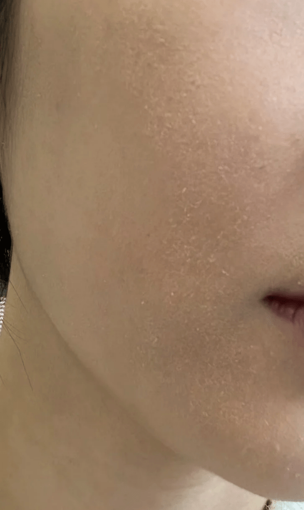 如何選擇適合秋冬季節的護膚產品？完整教學：乾燥肌膚的救星與油性肌膚的秘密