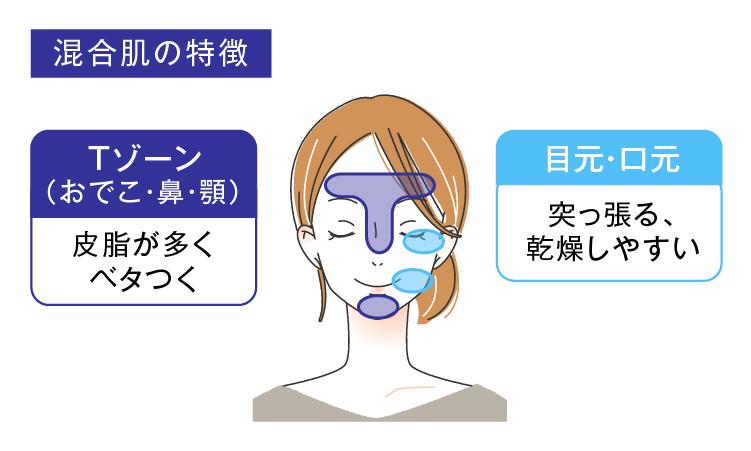 混合肌の管理方法とスキル：効率的ケアで美肌を手に入れる秘訣