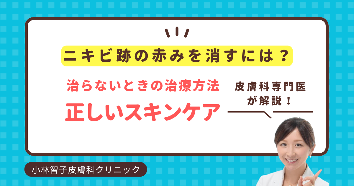 ニキビ跡を減らす！スキンケアの効率的改善方法｜専門医解説