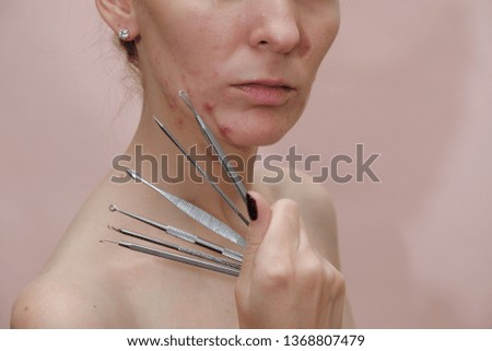 毛孔粗大與粉刺的惡性循環：終結循環，找回肌膚細緻