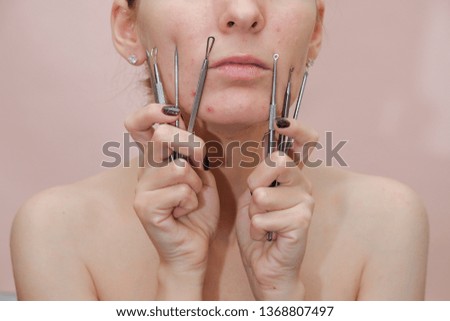 揭秘A醇長痘痘真相：完整指南帶你度過爆痘期，淨化肌膚！