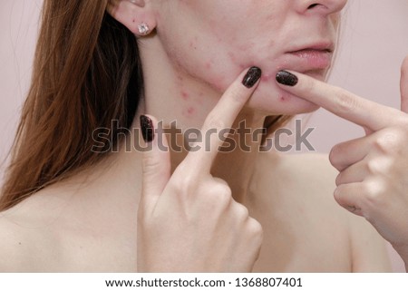 如何清潔與護理毛孔粗大的肌膚？完整教學及高效產品推薦