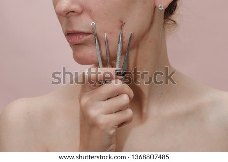 如何處理化妝後的粉刺問題？高效解決粉刺困擾的完整教學