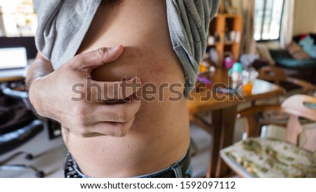 從頭到腳的季節過敏：頭皮、背部與四肢高效護理攻略