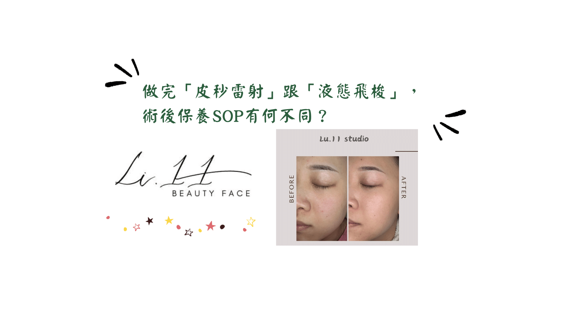 做完「皮秒雷射」跟「液態飛梭」，術後保養SOP有何不同？美容師的安心修護指南