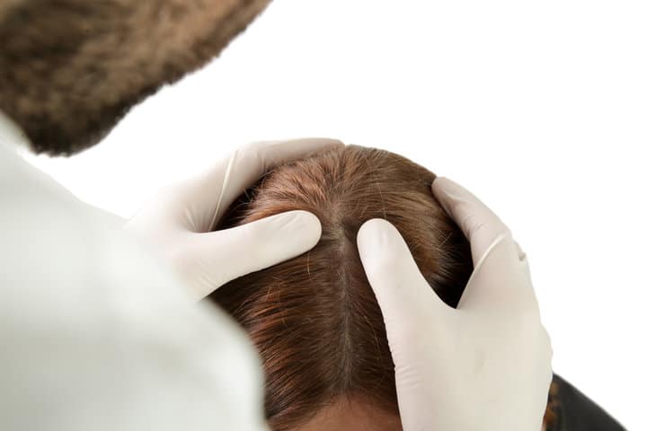 為何頭皮檢測對養髮療程如此重要？
