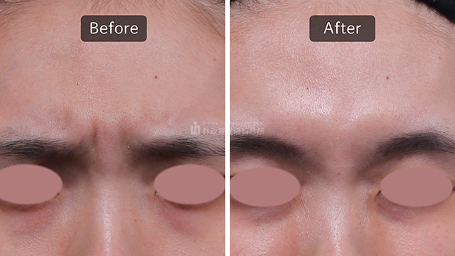 暗沉膚色如何快速改善？皮膚科醫生教你高效提亮膚色秘訣