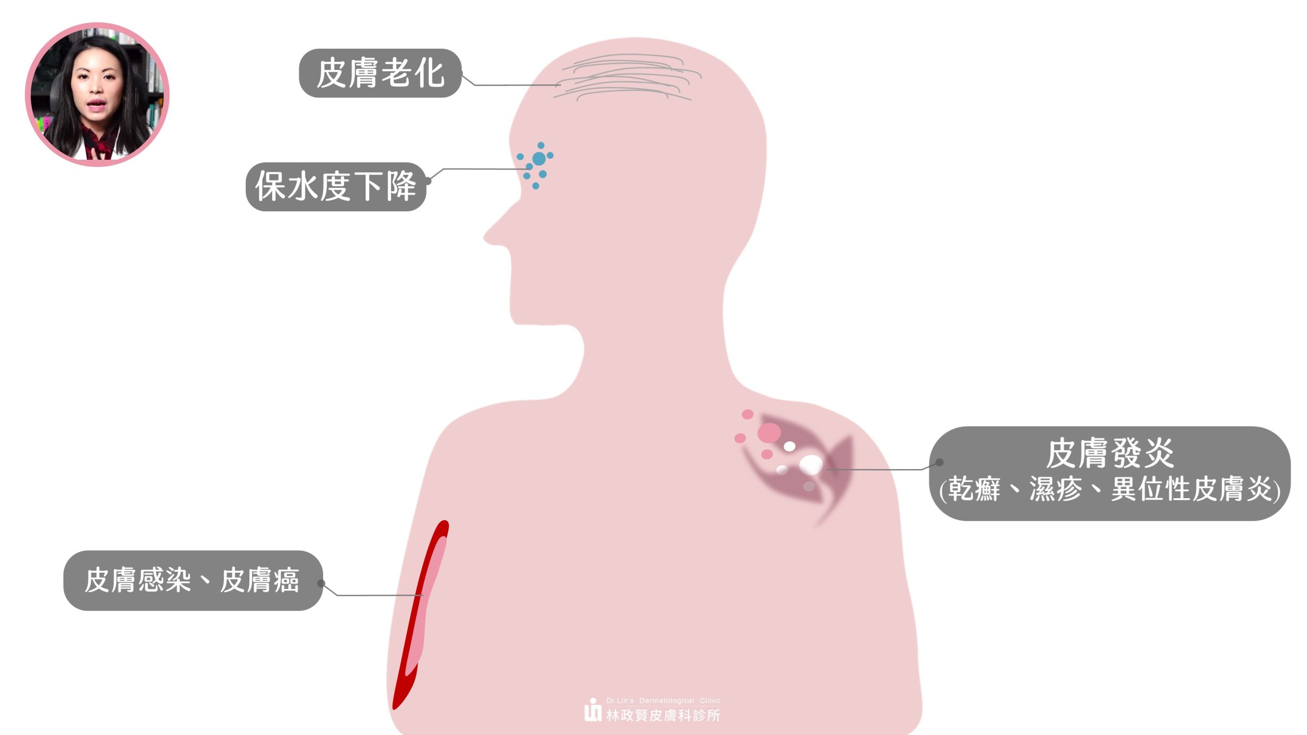 如何減少因空氣污染導致的肌膚問題？皮膚科醫生完整教學