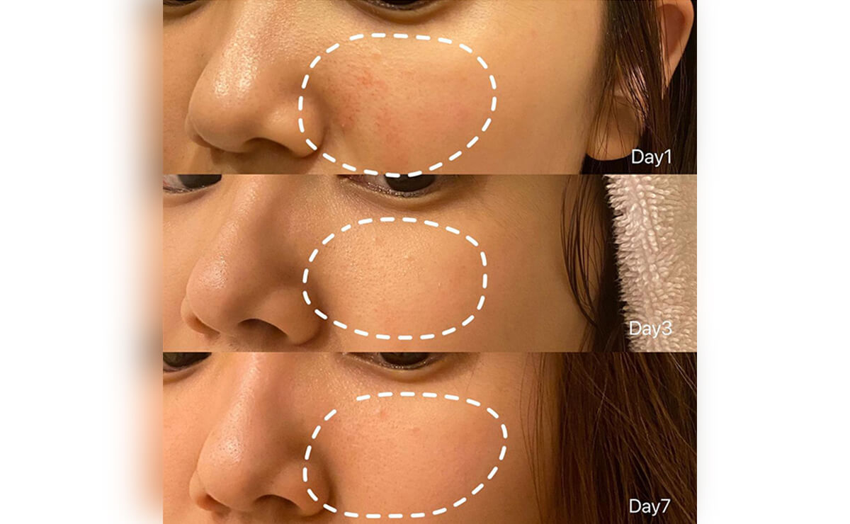 如何改善膚色不均問題？皮膚科醫生完整教學，告別暗沉肌膚！