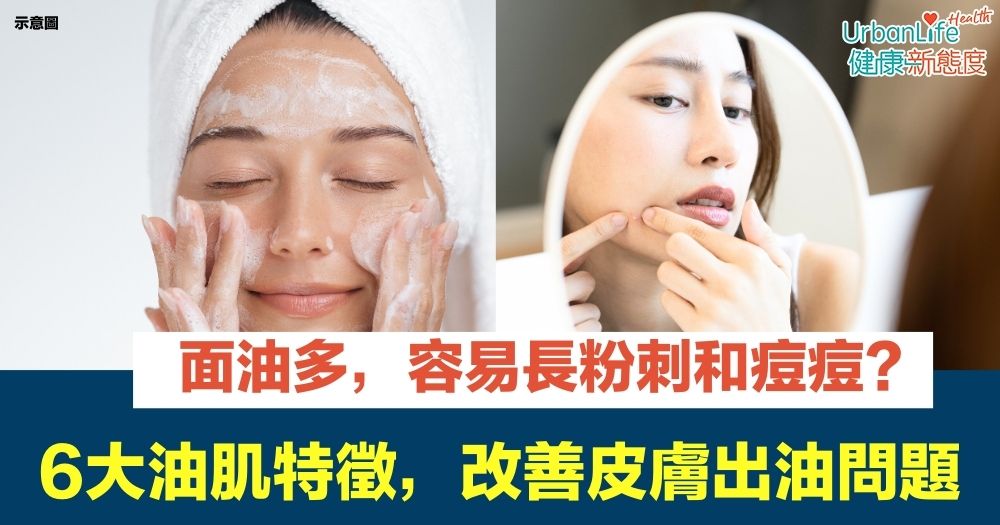 如何選擇適合油性肌的控油精華？痘痘肌膚控油精華高效選擇指南