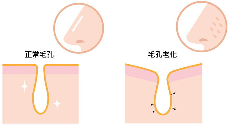 如何減少毛孔粗大現象：專業護膚專家的完整指南