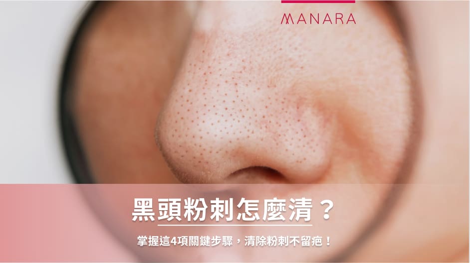 如何針對黑頭問題進行深層清潔？皮膚科醫生教你高效解決黑頭困擾！